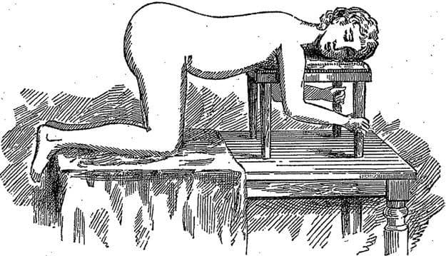 Figure 1 Matilda Stamper in the raised horizontal position. The original 1884 caption notes that the woodcut “shows the patient in this position, held by assistants.”